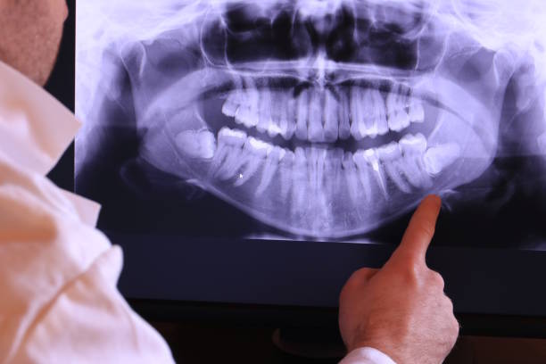 Best Emergency Tooth Extraction  in Helena, OK