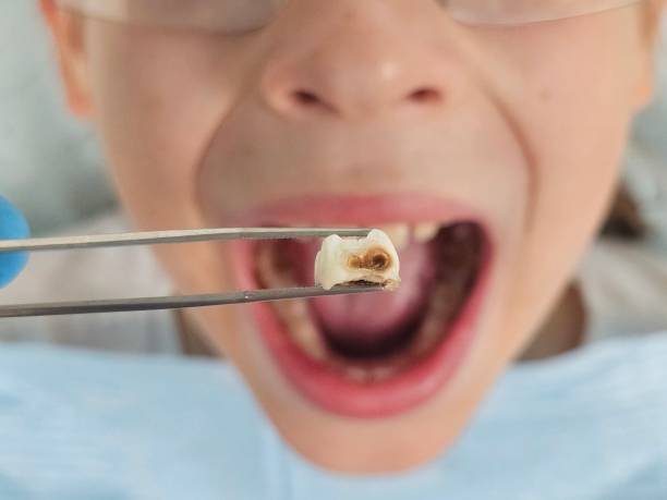 Best Knocked-Out Tooth Emergency  in Helena, OK